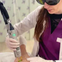 لیزر موهای زائد با دستگاه کندلا ۲۰۲۵