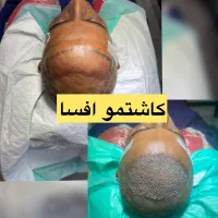 کاشتموی طبیعی