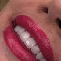 کامپوزیت اقساطی با ده سال گارانتی و پالیش رایگان