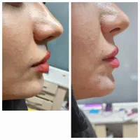 بهیار خانم