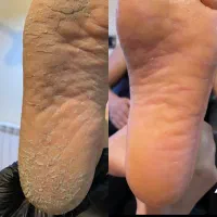 آموزش و‌خدمات پدیکور،اسپا و کفسابی درمانی و ریلکسی|خدمات آرایشگری و زیبایی|کرج, گلشهر|دیوار