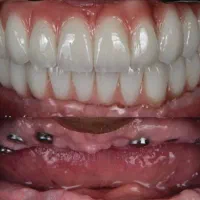 دندانپزشکی مرکز تخصصی ایمپلنت در تبریز|خدمات آرایشگری و زیبایی|مرند, |دیوار