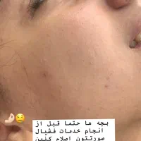 فیشیال و پاکسازی عمیق پوست|خدمات آرایشگری و زیبایی|مشهد, شهرک امام هادی (شهرک غرب)|دیوار