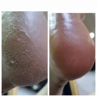 پدیکور و کف سابی|خدمات آرایشگری و زیبایی|رشت, بوسار|دیوار