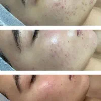 خدمات و آموزش تخصصی فشیال