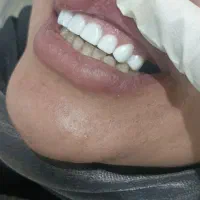 دندان سازی .دندان پزشکی|خدمات آرایشگری و زیبایی|خرم‌آباد, |دیوار