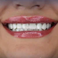 خدمات فوق تخصصی  دندانپزشکی کلینیک پالادیوم|خدمات آرایشگری و زیبایی|شیراز, معالی‌آباد|دیوار