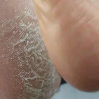 تخفیف در لاین کراتین و احیا.پدیکور.پاکسازی و فشیال|خدمات آرایشگری و زیبایی|کرمانشاه, |دیوار