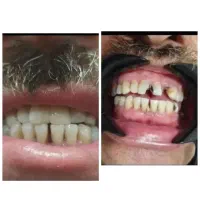 اورژانس دندانپزشکی در منزل شما شبانه‌روزی|خدمات آرایشگری و زیبایی|کرج, فاز ۱ مهرشهر|دیوار