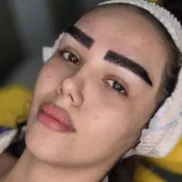 کاشت ابرو فقط 14میلیون (شرایطی)