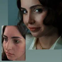 تخفیف ویژه جشنواره عیدعمل بینی تخصصی+مشاوره رایگان