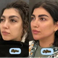 کلینیک تخصصی ژل و بوتاکس