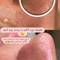 میکرو ابرو/موخورهگیری/فیشیال/میکاپ