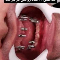 دندانپزشکی اقساطی با وام قرض الحسنه|خدمات آرایشگری و زیبایی|اصفهان, لاله|دیوار