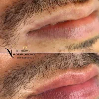 اسکالپ سر و فیبروز ابرو|خدمات آرایشگری و زیبایی|شیراز, ملاصدرا|دیوار
