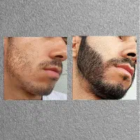 چی زدی|آرایشی، بهداشتی، درمانی|بنت, |دیوار