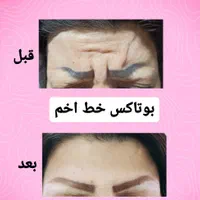کلینیک لیزربوتاکس مزو دکترعلی حسین‌ زاده پرندبیمه|خدمات آرایشگری و زیبایی|پرند, |دیوار