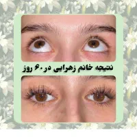 مژه ها و ابروهات رو تقویت کن|خدمات آرایشگری و زیبایی|کرمانشاه, |دیوار
