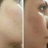 فروش همه نوع لوازم آرایشی درمانی چاقی لاغری ضدلک|آرایشی، بهداشتی، درمانی|دوگنبدان, |دیوار