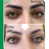 پاک‌کردن تتو و میکروبلیدینگ بدون لیزر + آموزش+مدرک|خدمات آرایشگری و زیبایی|تهران, جی|دیوار