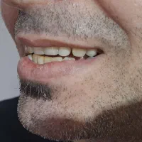 دندانسازی تخصصی|خدمات آرایشگری و زیبایی|بهبهان, |دیوار