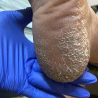 خدمات کفسابی و پدیکور (درمانی و زیبایی )پا|خدمات آرایشگری و زیبایی|مشهد, وکیل‌آباد|دیوار