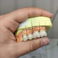 لابراتوار ثابت دندان