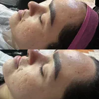 فیشال‌فیشیال‌پاکسازی‌پوست‌کربوکسی‌اسیدتراپی‌اموزش‌|خدمات آرایشگری و زیبایی|مشهد, شهید معقول|دیوار