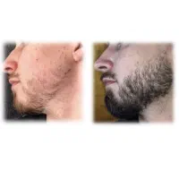 ریش نمیخاید
