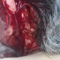 زیبایی درمانی|خدمات آرایشگری و زیبایی|بوشهر, |دیوار