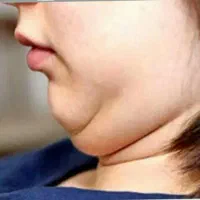 ژل لاغری شکم وپهلو‌وبازو بینی وغبغب اصل|آرایشی، بهداشتی، درمانی|اسلام‌‌آباد غرب, |دیوار