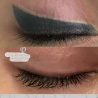 ریموو تک جلسه ای ابرو لب چشم (با تضمین یک جلسه ای)|خدمات زیبایی و سلامت|کرمانشاه, |دیوار