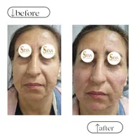 تزریق ژل و بوتاکس، ژل لب روسی و آموزش و ارائه مدرک|خدمات آرایشگری و زیبایی|کرج, شاهین‌ویلا|دیوار