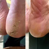 پدیکور حرفه ای از ۳۸۰ به بالا