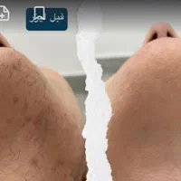 فیشال ولیزر مدیکا ژاندارمری