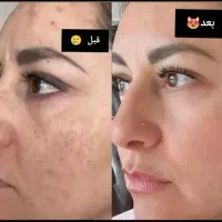 کرم وی ای پی اصل صدرصد تضمینی و بدون بازگشت|آرایشی، بهداشتی، درمانی|یاسوج, |دیوار