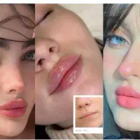 نیازمند مدل ژل و بوتاکس