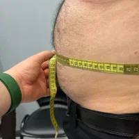 رفع چاقی موضعی شکم و پهلو توسط پزشک متخصص