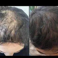 تخفیف 80درصدی در قم  پی ار پی(۹۶۰) فقط تا جمعه|خدمات آرایشگری و زیبایی|قم, زنبیل آباد|دیوار
