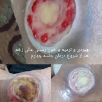 بخیه و تزریقات و پانسمان پیشرفته|خدمات آرایشگری و زیبایی|اهواز, منازل کارون|دیوار