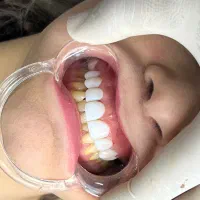 جشنواره یلدایی ایمپلنت فردیس