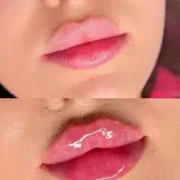 آفر ویژه خدمات زیبایی ژل فیلر بوتاکس لیفت|خدمات آرایشگری و زیبایی|شاهینشهر, طالقانی|دیوار