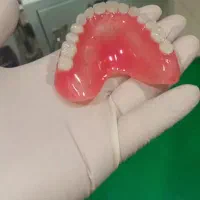 دندانسازی ((دندان مصنوعی))|خدمات آرایشگری و زیبایی|ارومیه, |دیوار