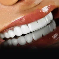 عصبکشی/کامپوزیت/کشیدن دندان|خدمات آرایشگری و زیبایی|ساری, |دیوار