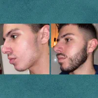 اقدام کن قبل از اینکه دیر بشه