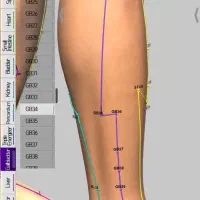 طب سوزنی|خدمات آرایشگری و زیبایی|شیراز, شاه قلی بیگی|دیوار