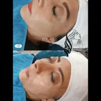 فیشیال پوست|خدمات آرایشگری و زیبایی|فلاورجان, |دیوار