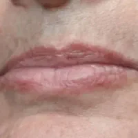 پوست و زیبایی