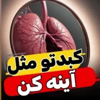درمان کبدچرب