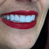 کامپوزیت با شرایط اقساط